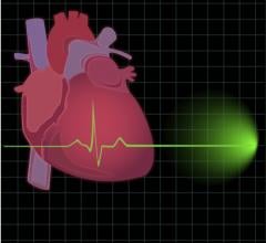 BioControl Medica Clinical Study CardioFit Vagus European Journal of Heart Failu