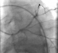 IAC Releases Cardiovascular Catheterization Accreditation Program