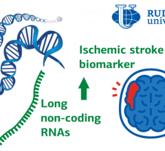 RUDN doctors analyzed the latest research on the use of RNA for the treatment and diagnosis of ischemic stroke. And, although it is too early to talk about clinical use, one of the RNAs turned out to be both a promising biomarker and a therapeutic target 