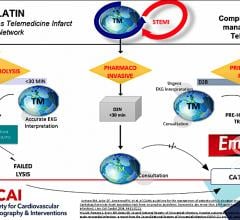The protocol chart for the LATIN STEMI telecardiology program.