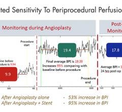 The Pedra Blood Perfusion Index tracks real-time changes in foot tissue perfusion attendant with balloon inflation and deflation during an angioplasty procedure.