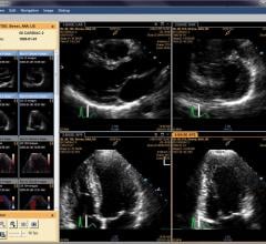 Cardiac Imaging Reveals Roots of Preeclampsia Damage in Pregnant Women
