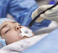 Latest innovation has the potential to reduce anesthesia during minimally invasive procedures 
