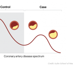 Individuals with coronary artery disease exist on a spectrum of disease, such as the amount of plaque build-up in the arteries of the heart; however, the disease is conventionally classified as broad categories of case (yes disease) or control (no disease), which may result in misdiagnosis. A digital marker for coronary artery disease derived from machine learning and electronic health records can better quantify where an individual falls on the disease spectrum. Credit: Icahn School of Medicine at Mount Si