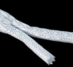 ADVANCE Trial compares sac regression in the Medtronic Endurant II/IIs stent graft system and the Gore® Excluder AAA Device Family systems