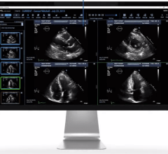 When integrated with InView, Ascend’s high-performance zero-footprint Cardiovascular viewer, Us2.ai’s FDA-cleared and CE Marked echocardiogram algorithms automate measurements and pre-populate structured report templates. 