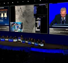 A live Corevalve TAVR case in the main arena at TCT 2017. Structural heart has moved from a science fiction discussion in future technology sessions at TCT a decade ago to now being a major portion of what the conference discusses for today's clinical practice.
