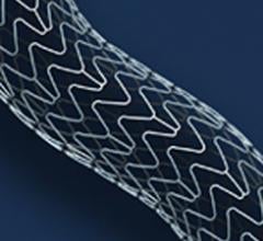 xience prime xpedition V antiplatelet stents eluting clinical trial study cath