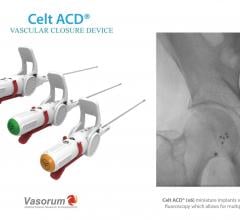 Vasorum Launches Celt ACD Second-Generation Vascular Closure Device in the U.S.