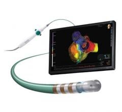 Abbott Announces CE Mark for New Cardiac Ablation Catheter