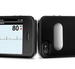 AliveCor Heart Monitor iPhone 