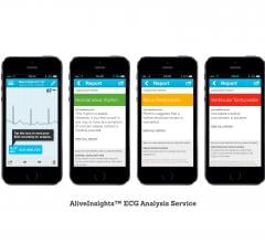 cardiac diagnostics software mobile devices ecg monitoring services alivecor