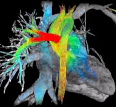 Arterys, Arterys System, ViosWorks, GE Healthcare, MRI, blood flow, RSNA 2015