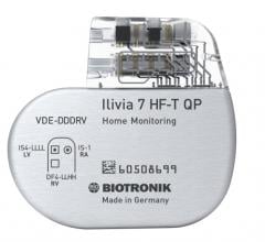 CASTLE-AF Study shows Catheter Ablation of Atrial Fibrillation is First-Line Treatment for Heart Failure Patients. Biotronic Ilivia 7 ICD.