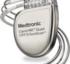 New Data Reveal Medtronic CRT Devices Improve Therapy Delivery and Reduce Healthcare Costs