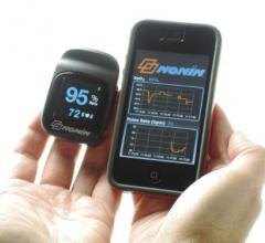 Nonin Medical, NoninConnect Model 3230, Bluetooth Smart, wireless finger pulse oximeter, iOS-compatible, Apple