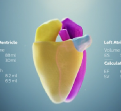 Philips, Epiq 7, Anatomically Intelligent Ultrasound, AIUS, cardiac ultrasound