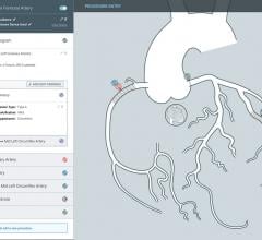 ZHealth Launches Etch Cardiovascular Coding Software