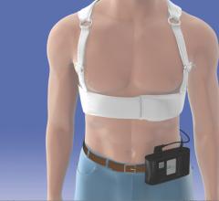 The Zoll Lifevest Wearable External Defibrillator Offers a Bridge Therapy and buys time for physicians to determine if an implantable defibrillator is needed. 