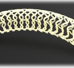 stents, bioresorbable, clinical trial, clinical study