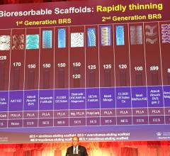 Bioresorbable stents (BRS) in development presented by Gregg Stone, M.D., during TCT 2017. Several of the players listed on the slider put their BRS development programs on hold after the negative data from the ABSORB III Trial, but a handful of smaller companies are still pushing the technology forward. #TCT #TCT2018