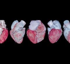 Cardiac CT isn't just a diagnostic tool — it's an essential component of cardiovascular health