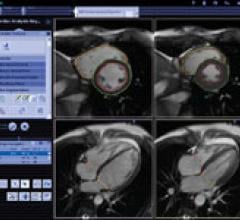 Siemens, syngo.MR Cardiac 4-D, MRI software