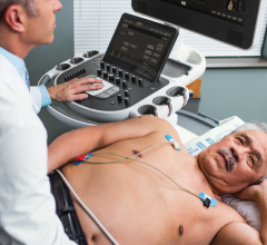 The Philips Epiq cardiac ultrasound system includes automated measurements and anatomical identification based on an artificial intelligence algorithm. #ASE #ASE16