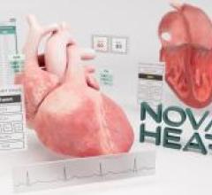 Nova Heart creates a dynamic, 3D digital twin of a patient’s heart using 2D transthoracic echocardiogram data. 