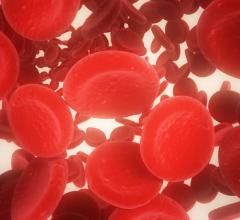 New Oral Anticoagulant Drugs Associated with Lower Kidney Risks