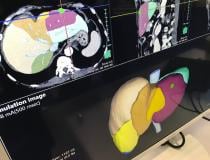 Example from Fujifilm of an automated liver segmentation application for CT scans. This is used for surgical resection planning and the images can be used during the OR procedure to aid guidance. #HIMSS #HIMSS21 
