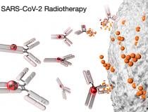 I-131 has been proposed as a radiation therapy to target and kill the SARS-CoV-2 virus.