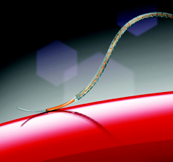 Abbott Announces CE Mark for World's Longest Coronary Drug Eluting