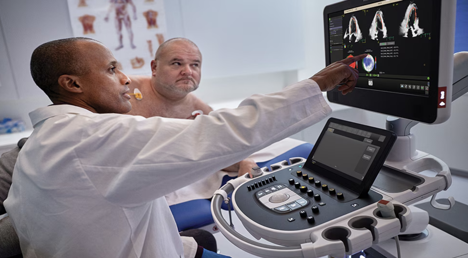 Results Involving Philips FDA-cleared AI-enabled Cardiovascular Ultrasound Platform to be Presented at American Society of Echocardiography Scientific Sessions, ASE 2024 - Vimarsana News