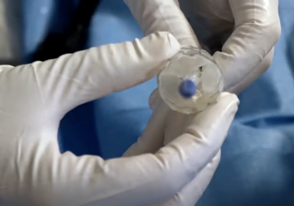 PolyVascular Awarded $2 Million Small Business Innovation Research Grant to Bring the First Polymer-Based Heart Valve for Children to Clinical Trials - Vimarsana News