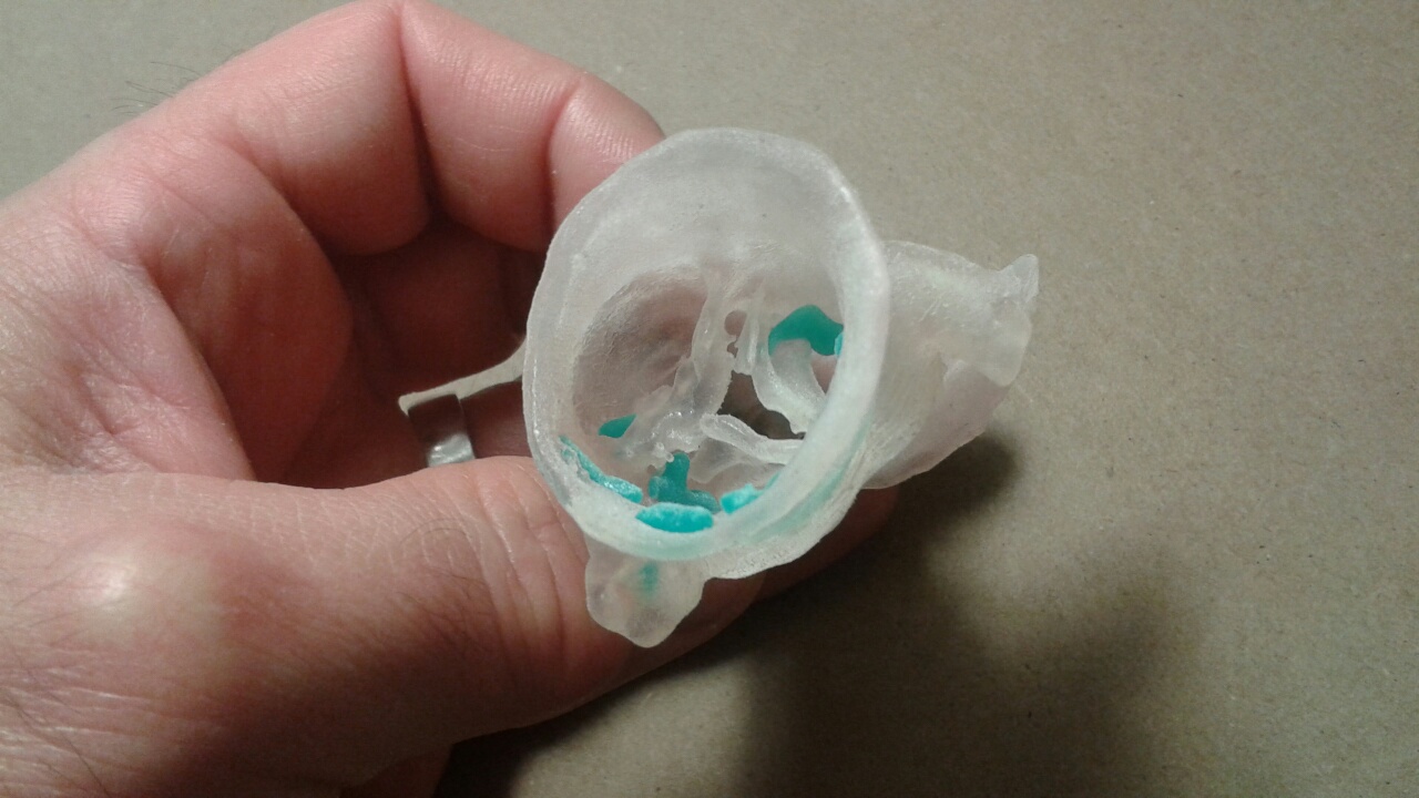 The Future Of 3 D Printing In Medicine Daic