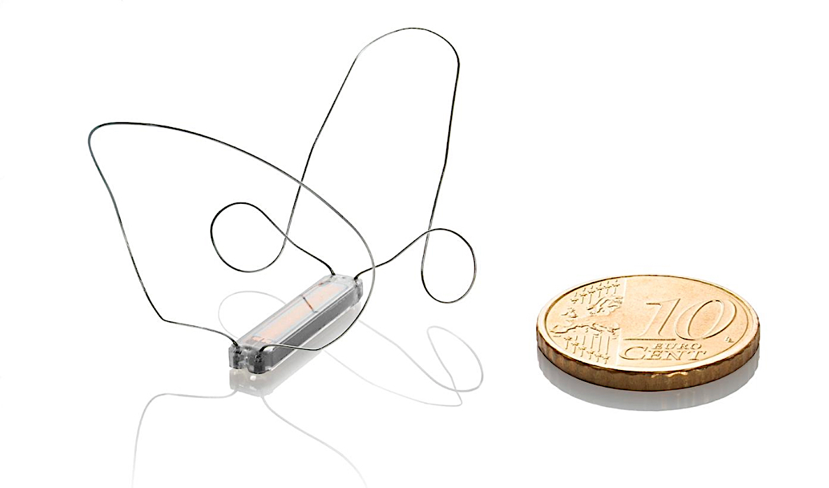  SIRONA first-in-human study, which described a pro-active heart failure management strategy incorporating ambulatory pulmonary artery pressure monitoring with the Cordella Heart Failure System.