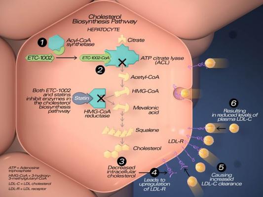 Bempedoic Acid for Cholesterol Lowering in Statin Intolerant Patients