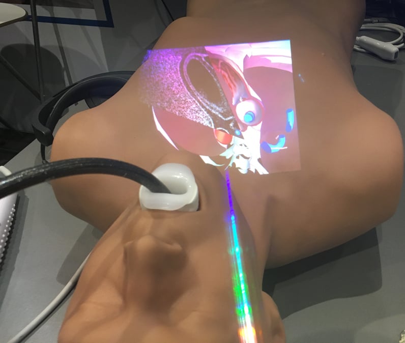 Augmented reality being used for transesophageal echo (TEE) cardiac imaging training. Photo by Dave Fornell