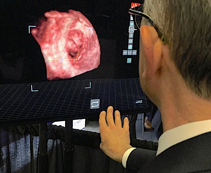 Echopixel holograms in the cath lab