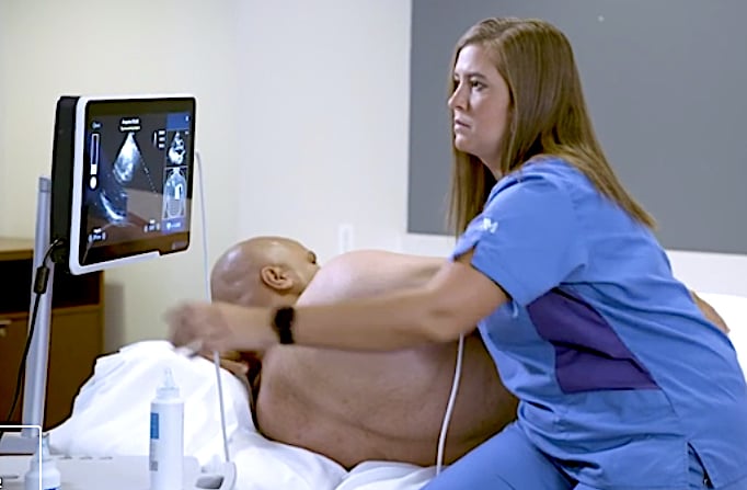 The FDA granted marketing authorization of the Caption Guidance software to Caption Health Inc. in February 2020. It uses artificial intelligence to guide users to get optimal cardiac ultrasound images in a point of care ultrasound (POCUS) setting.