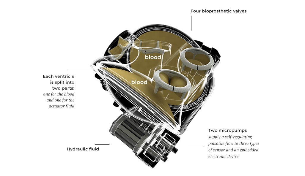 he U.S. Food and Drug Administration (FDA) has approved Carmat's investigational device exemption (IDE) application to start a U.S. early feasibility study (EFS) of its total artificial heart.