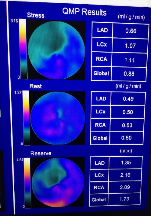 PET QMP imaging