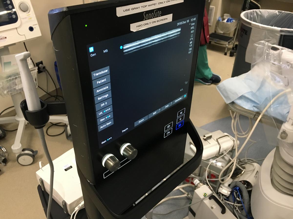 Sonosite Ultrasound system used for vascular access in the cath lab at the University of Colorado.