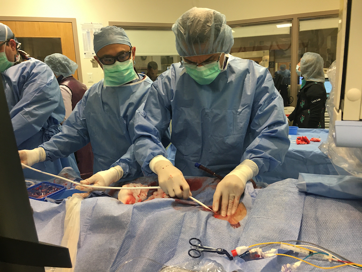Insertion of ECMO cannula at Tufts Medical Center in December 2019. ECMO is now cleared by the FDA for COVID-19 patient support.