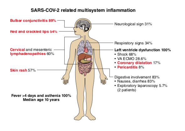 MIS-C COVID-19 related symptoms according to findings in a Circulation tsudy from France and Switzerland.