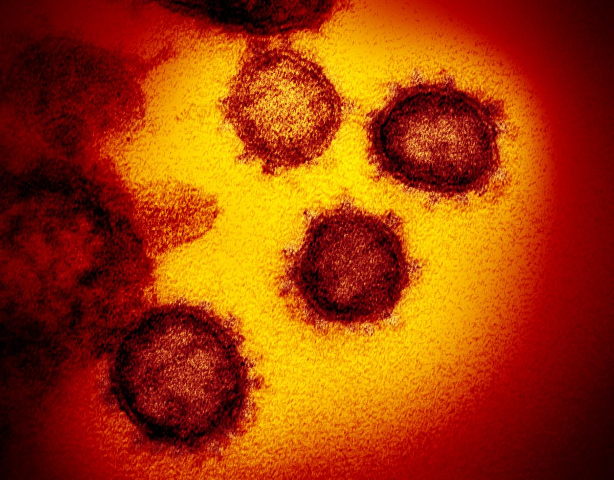 The novel coronavirus (COVID-19) imaged by the National Institutes of Health (NIH).