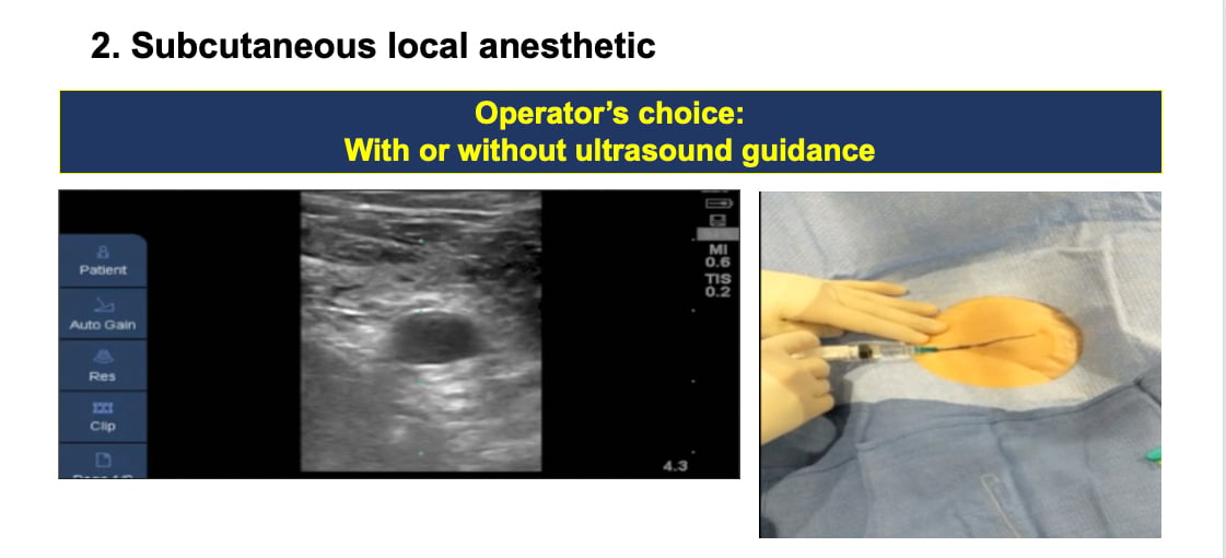 Vascular Access for percutaneous interventional procedures step 2