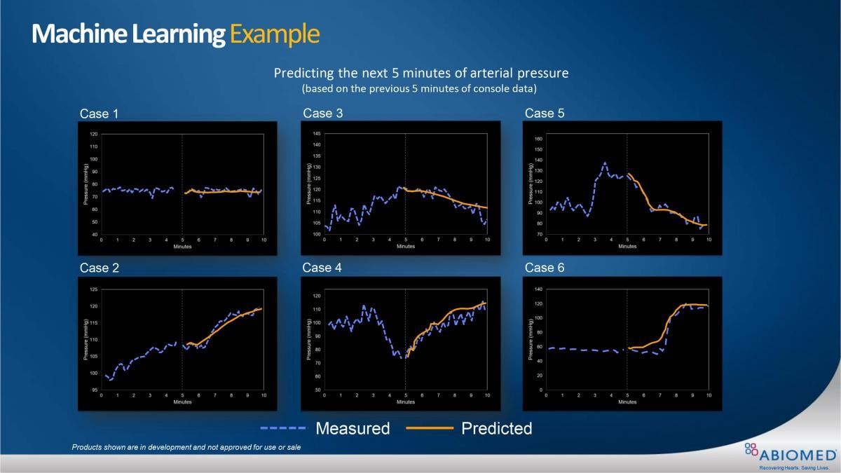 Figure 2: Six cases of machine learning using Impella Console data to predict patient arterial pressures over the next five minutes.