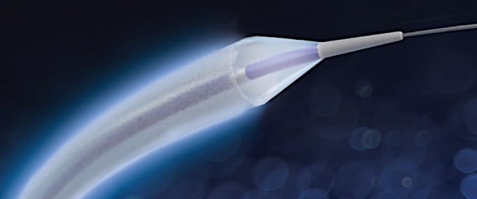 The MedAlliance Selution SLR (Sustained Limus Release) sirolimus-eluting balloon.